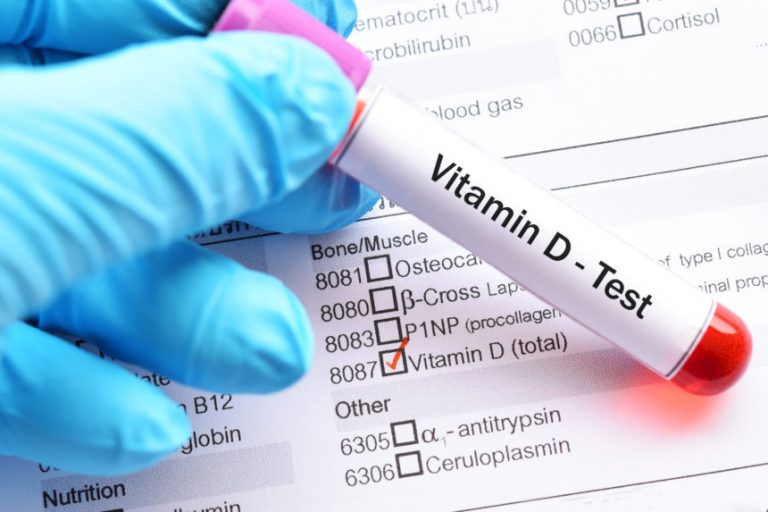 vitamin-d3-does-not-improve-time-to-severe-exacerbation-in-pediatric